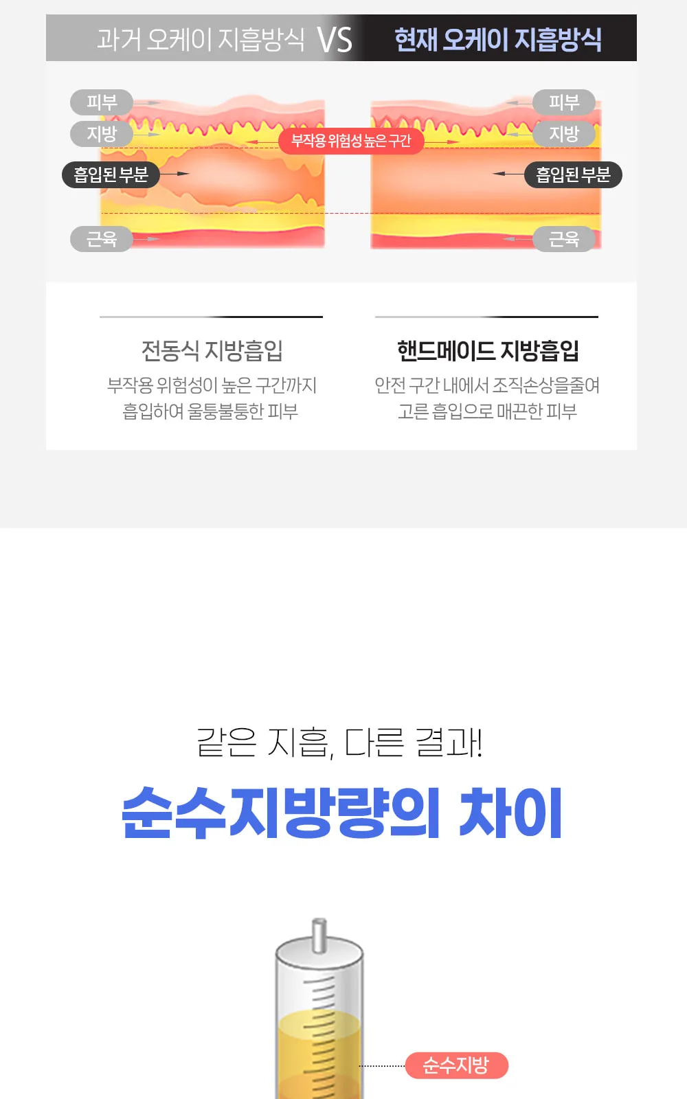 시술 상세 6