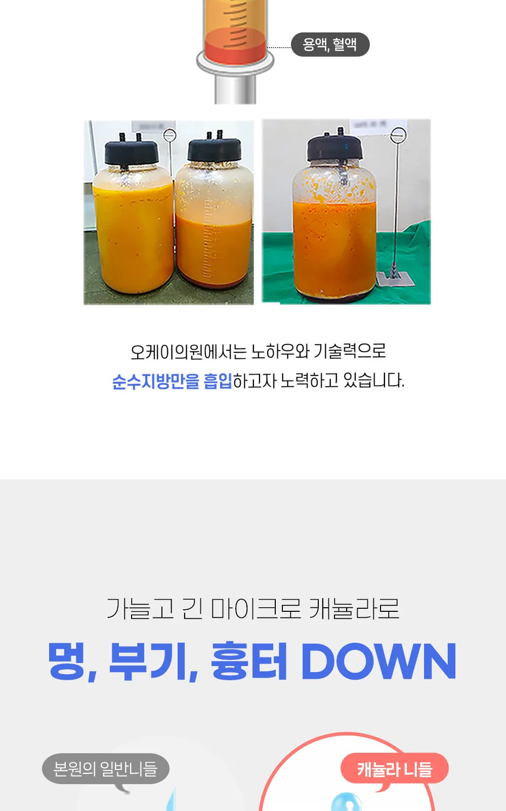 시술 상세 7