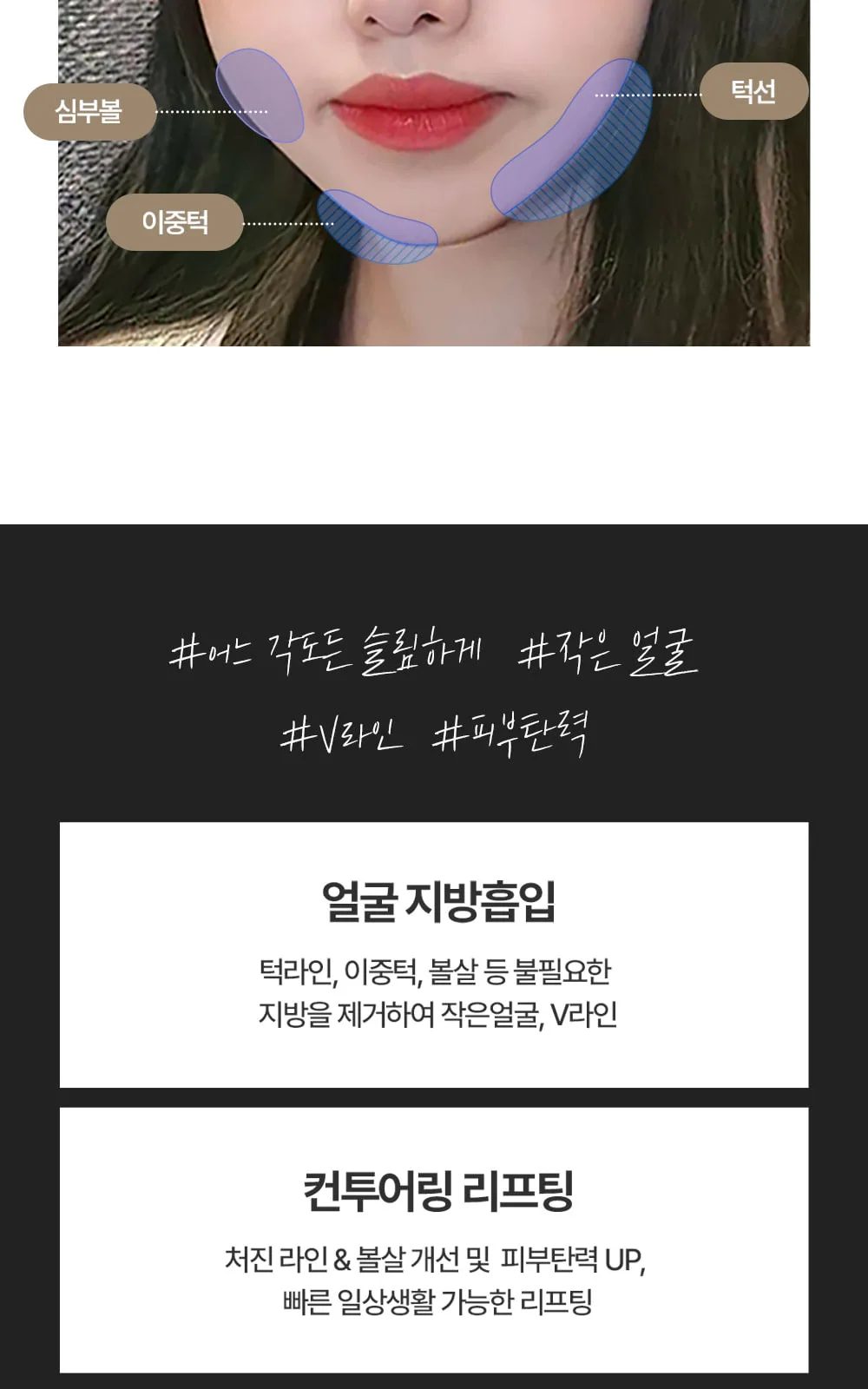 시술 상세 3