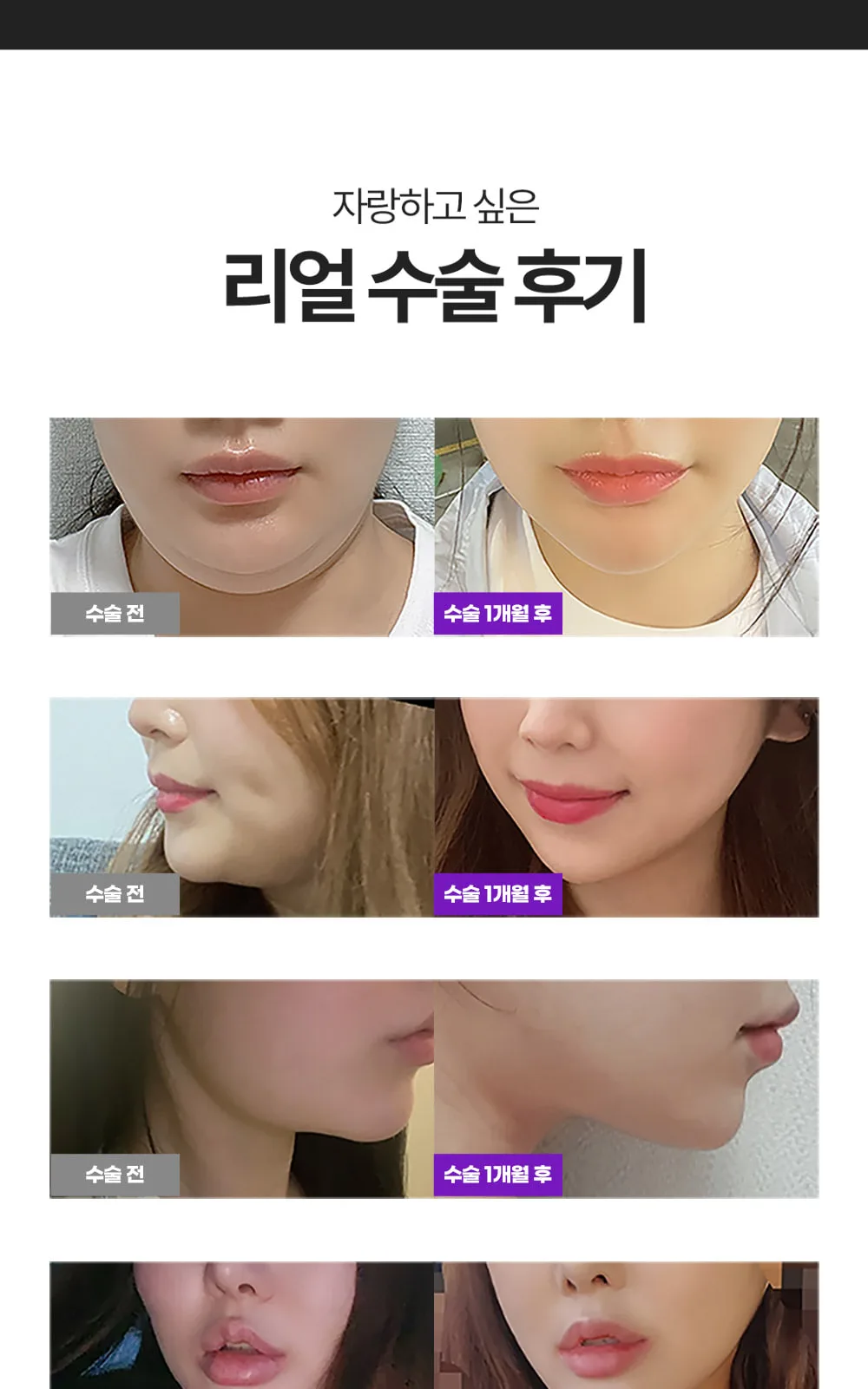 시술 상세 4