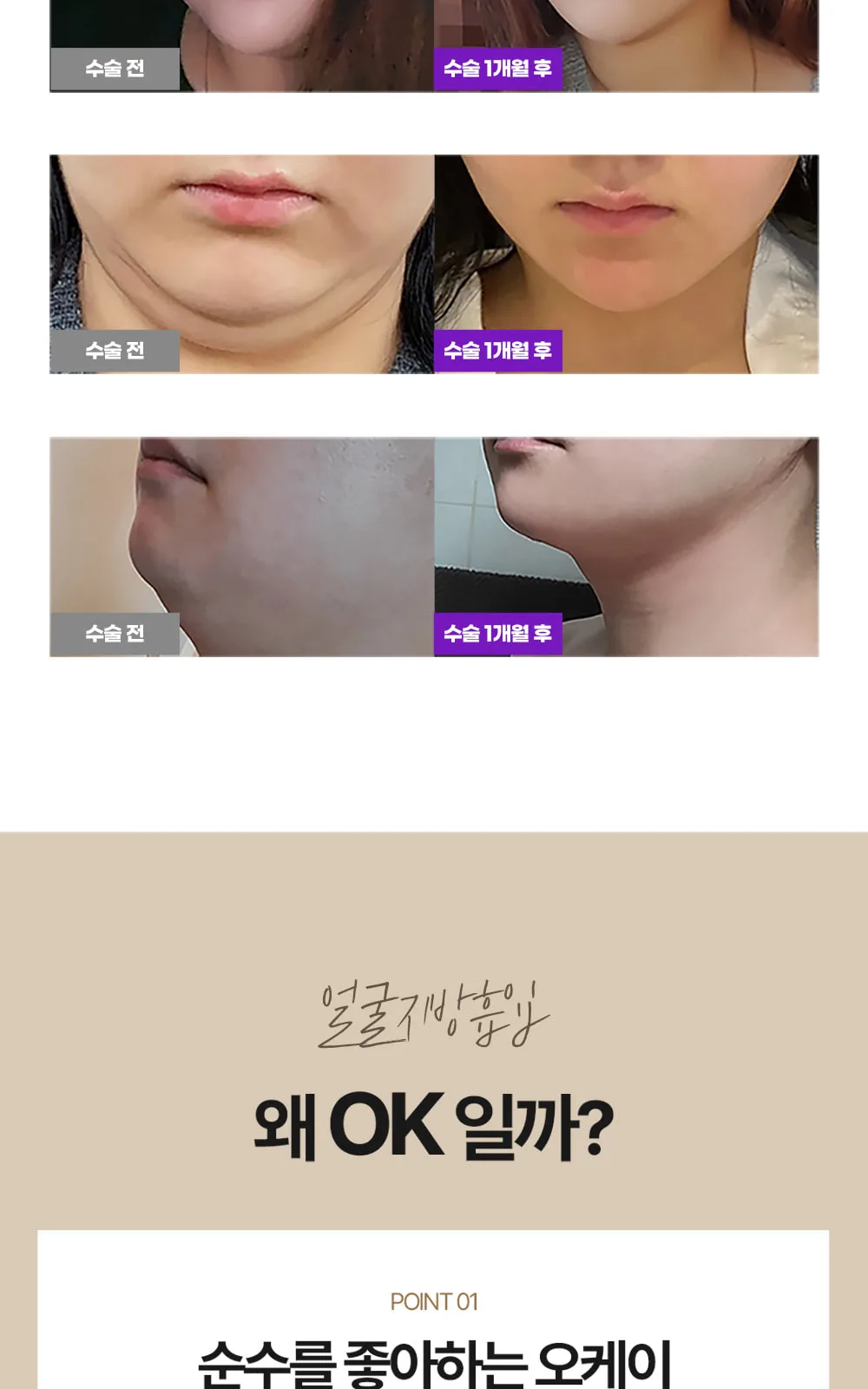 시술 상세 5