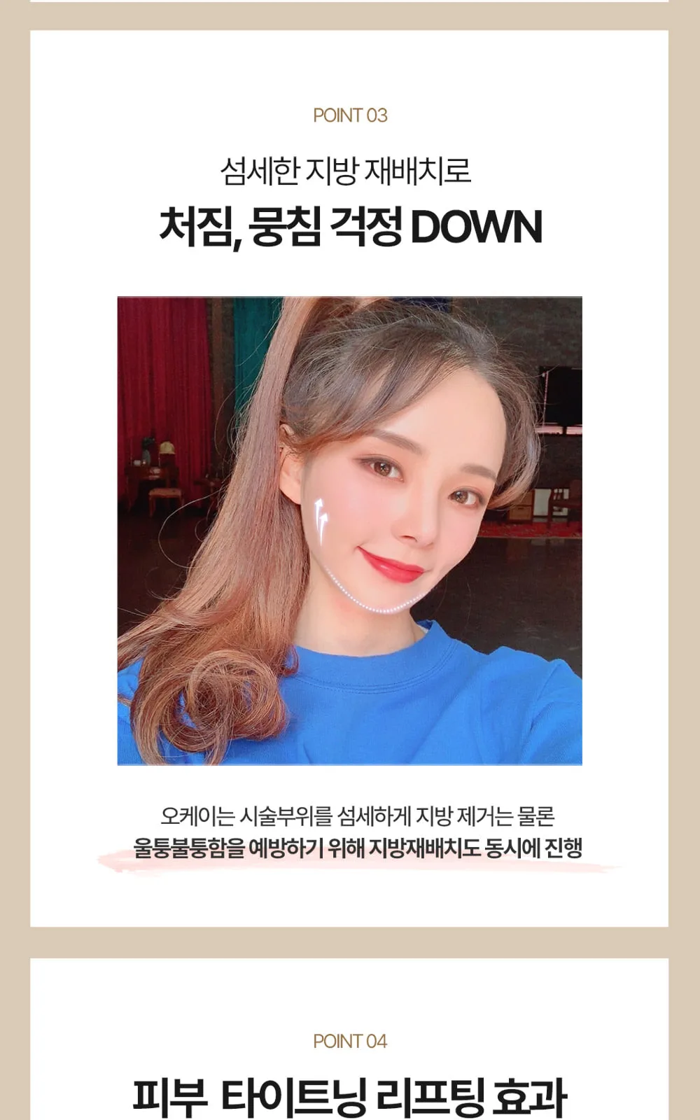 시술 상세 7