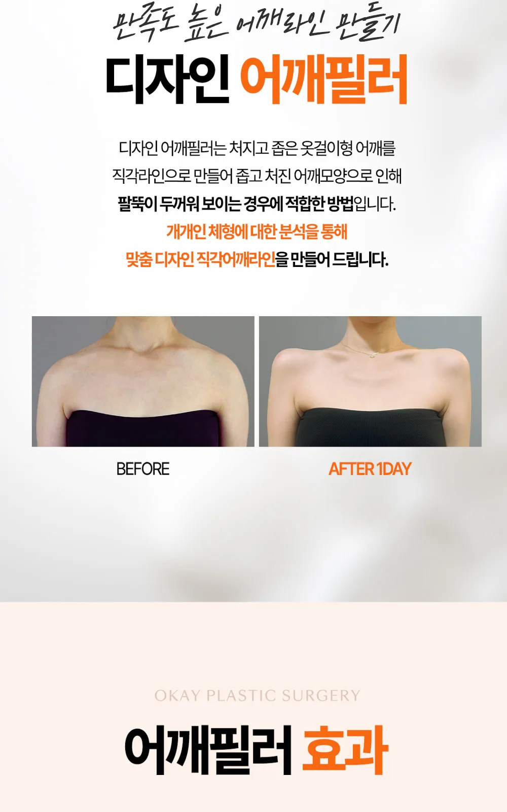 시술 상세 2