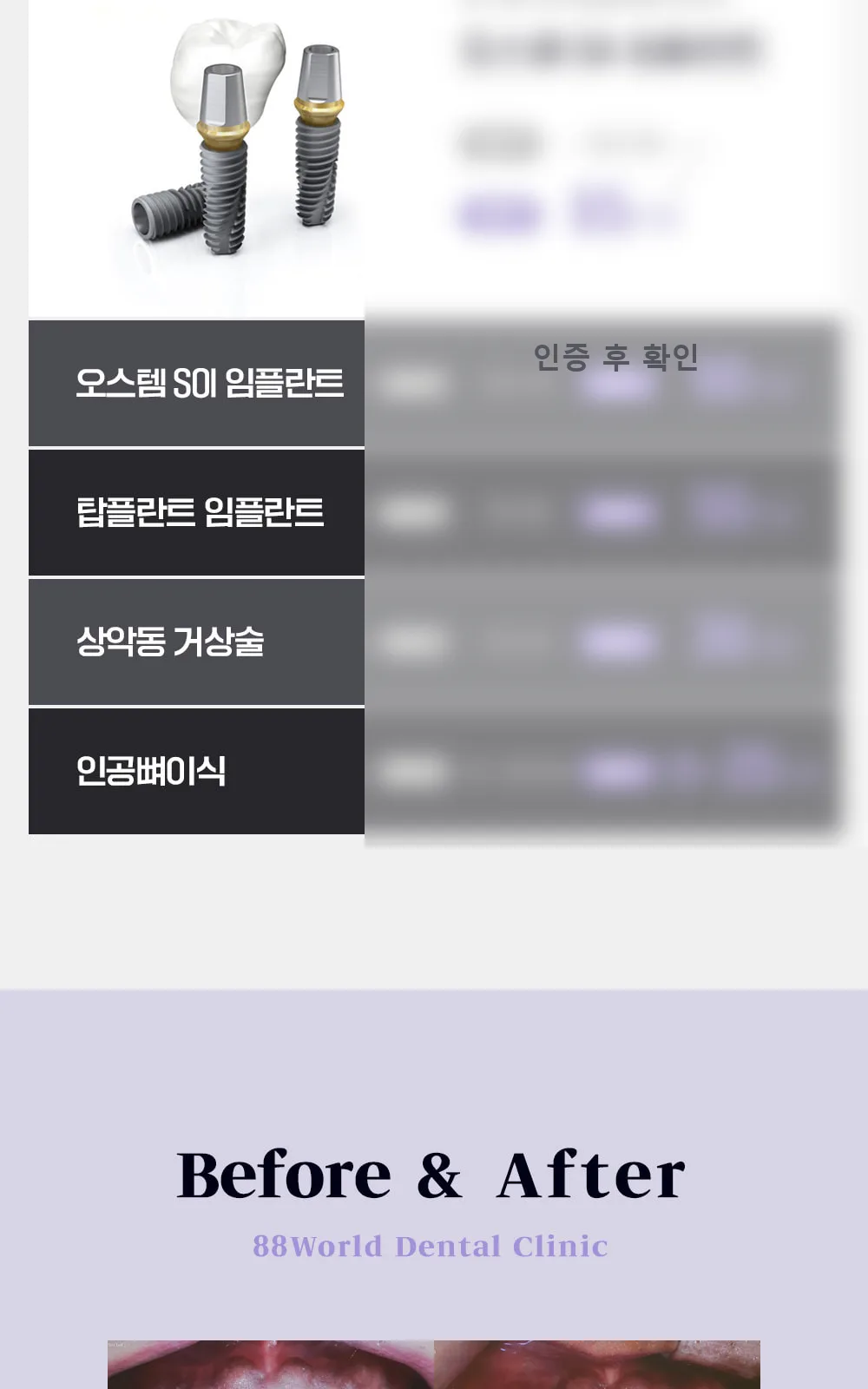 시술 상세 5