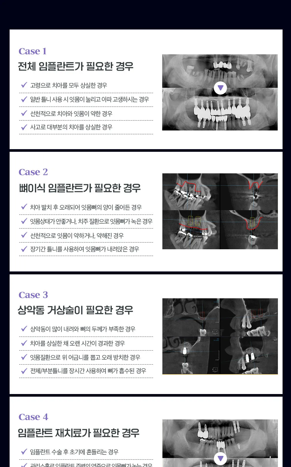 시술 상세 7
