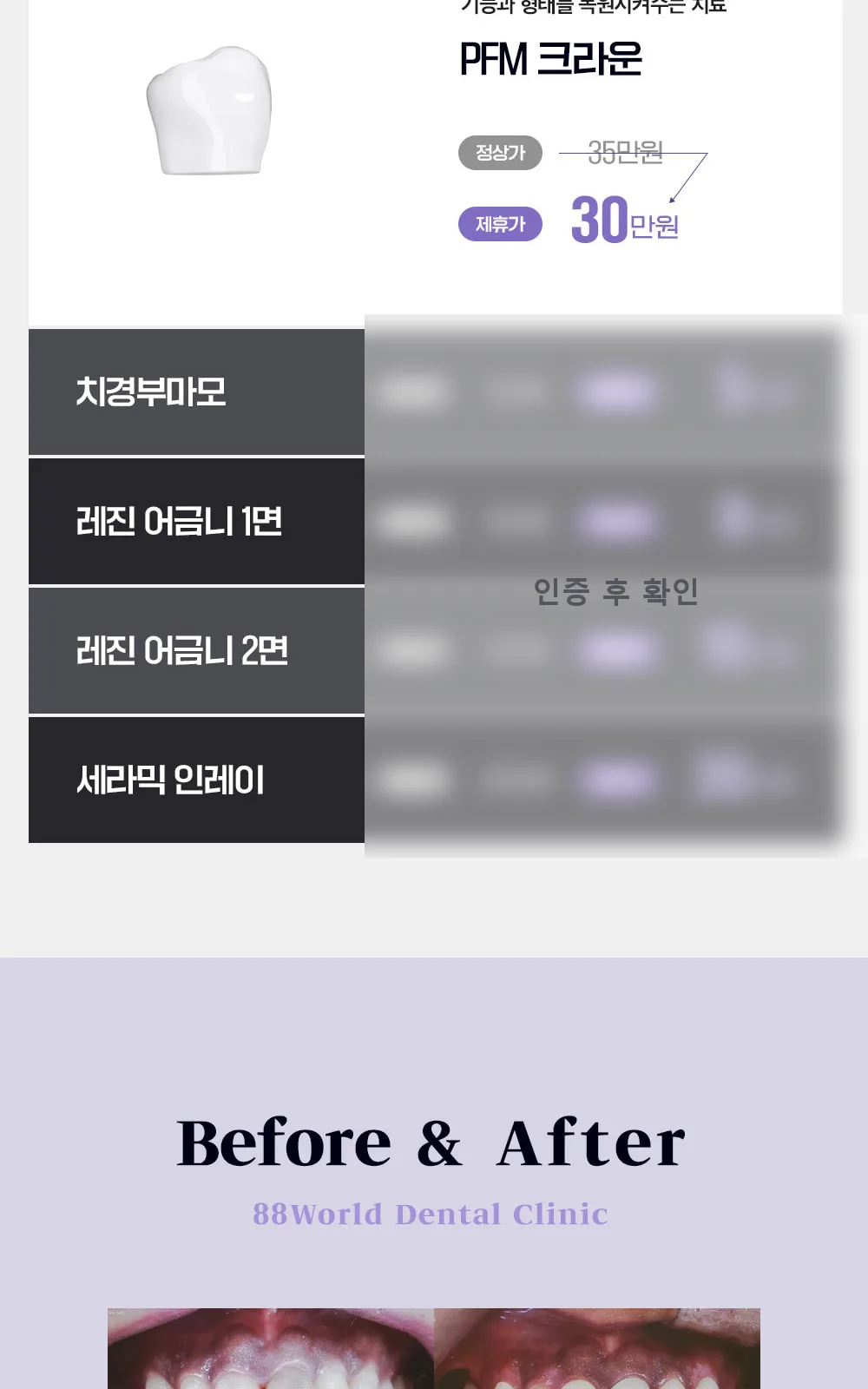 시술 상세 5