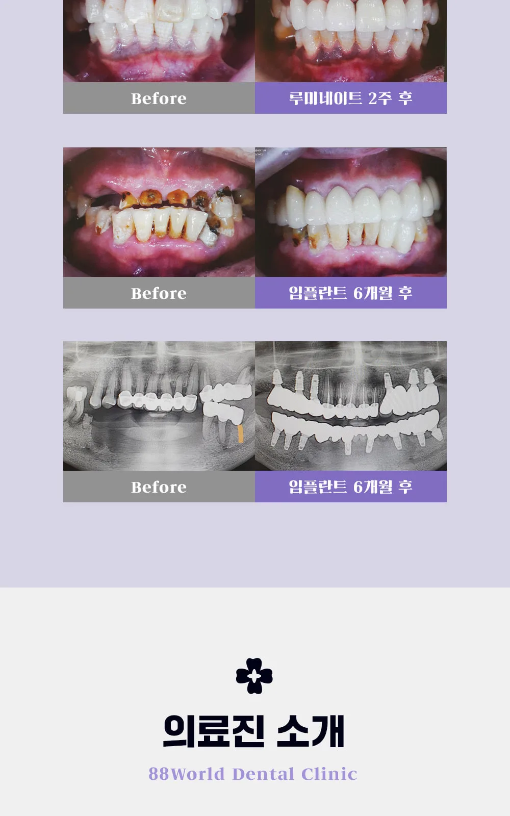시술 상세 6