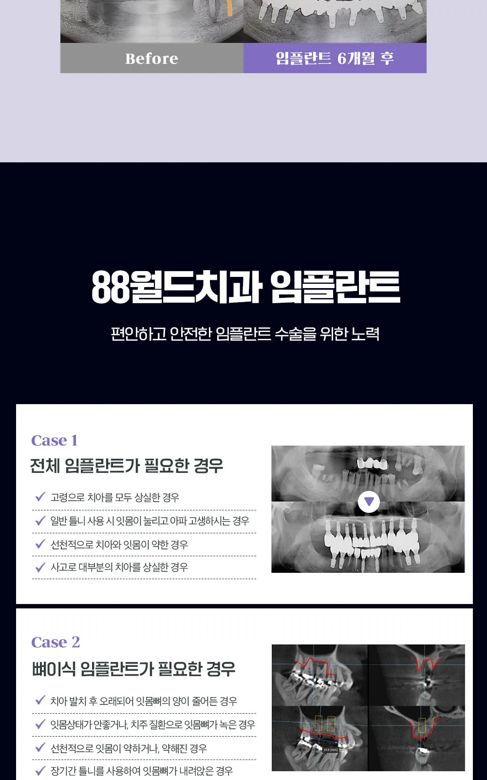 시술 상세 8