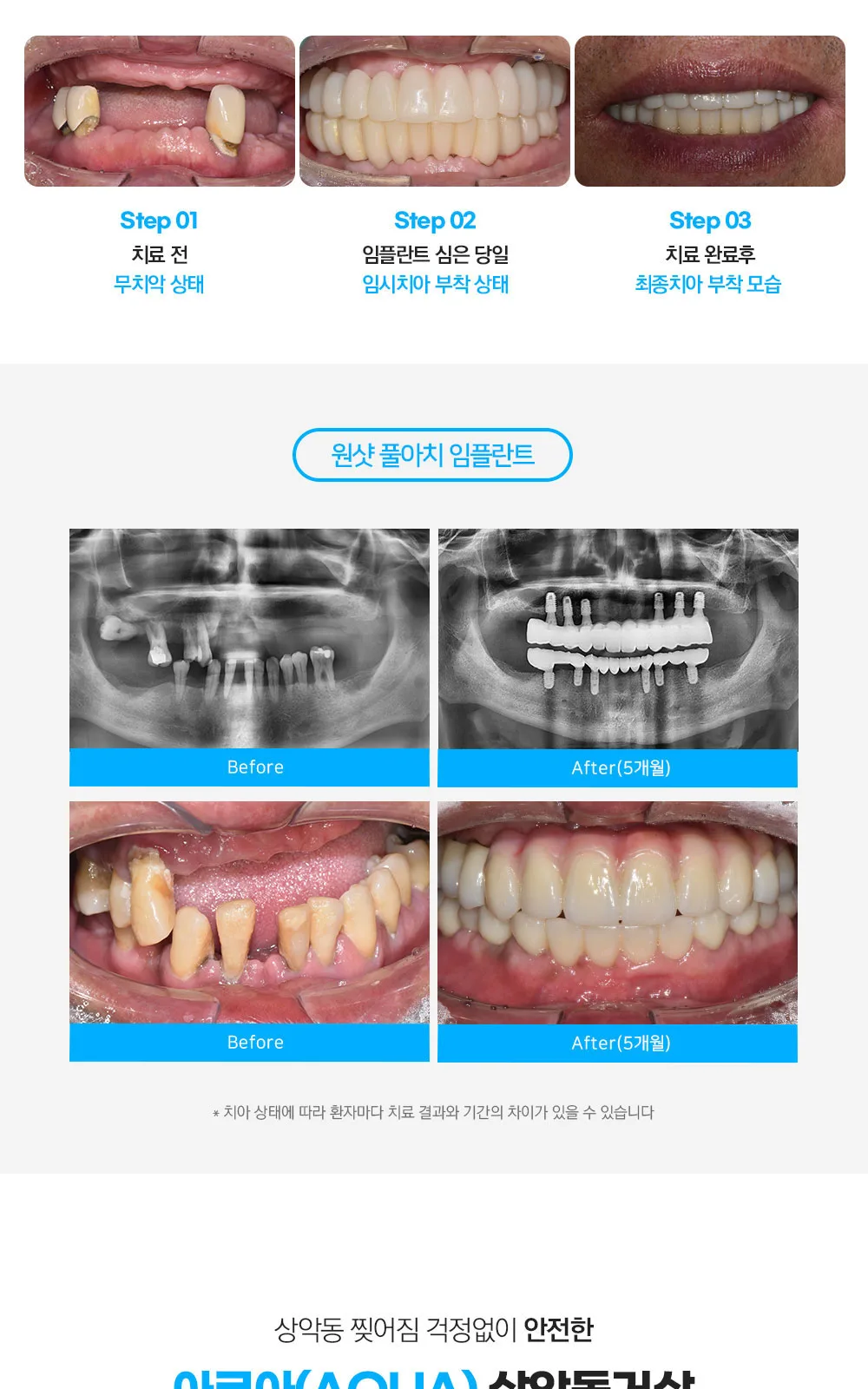 시술 상세 3