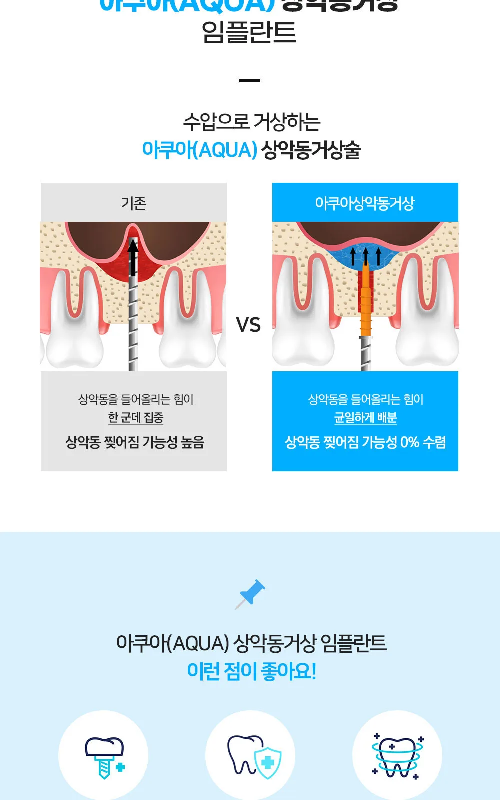 시술 상세 4