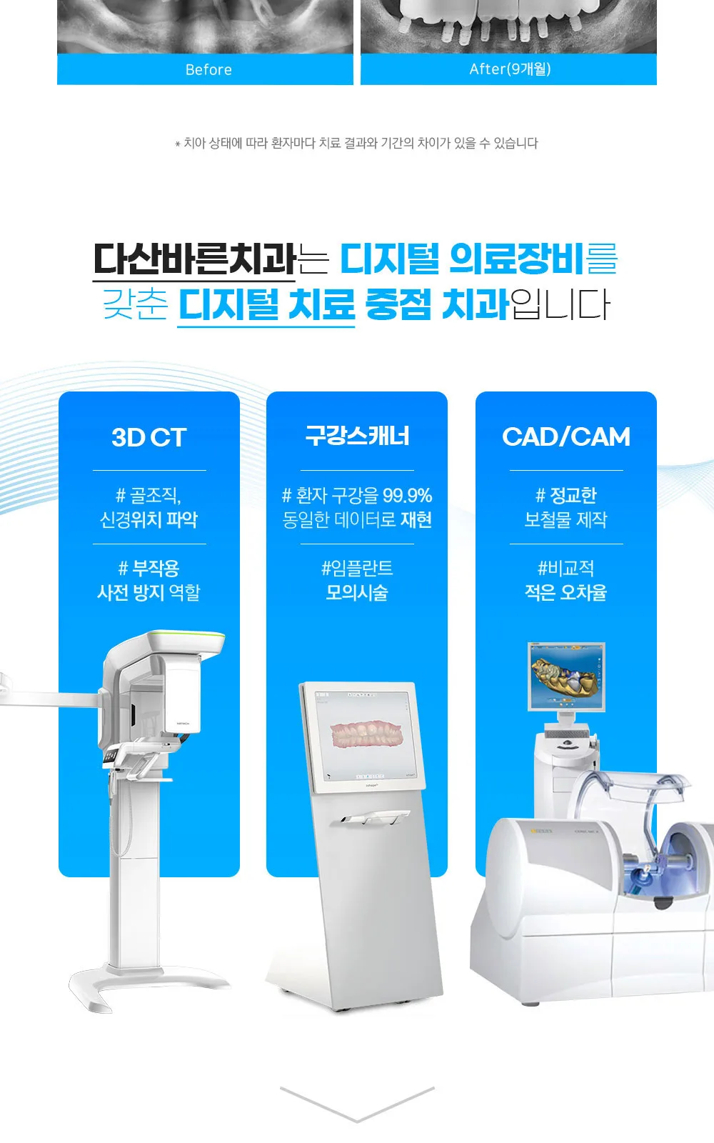시술 상세 7