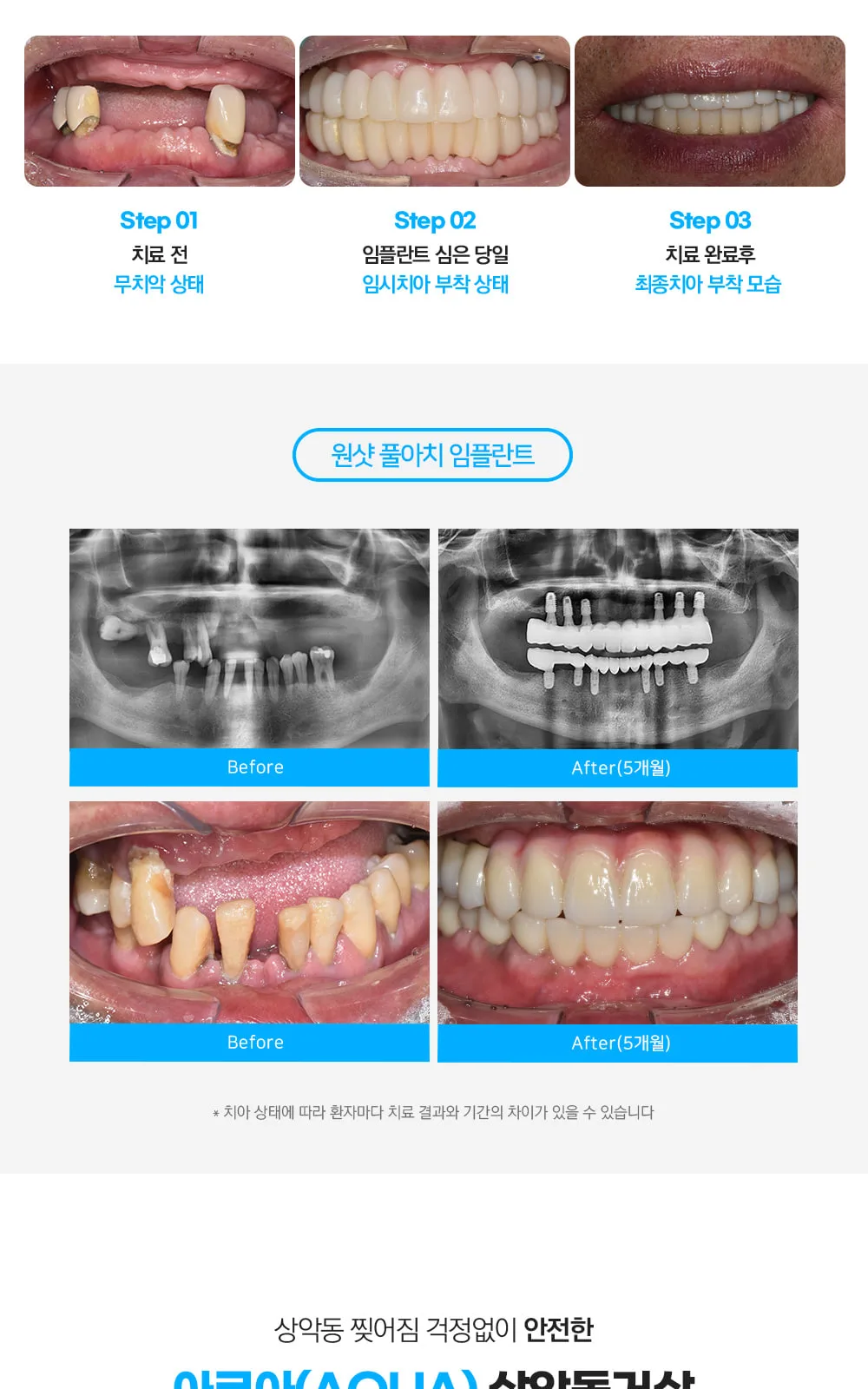시술 상세 3
