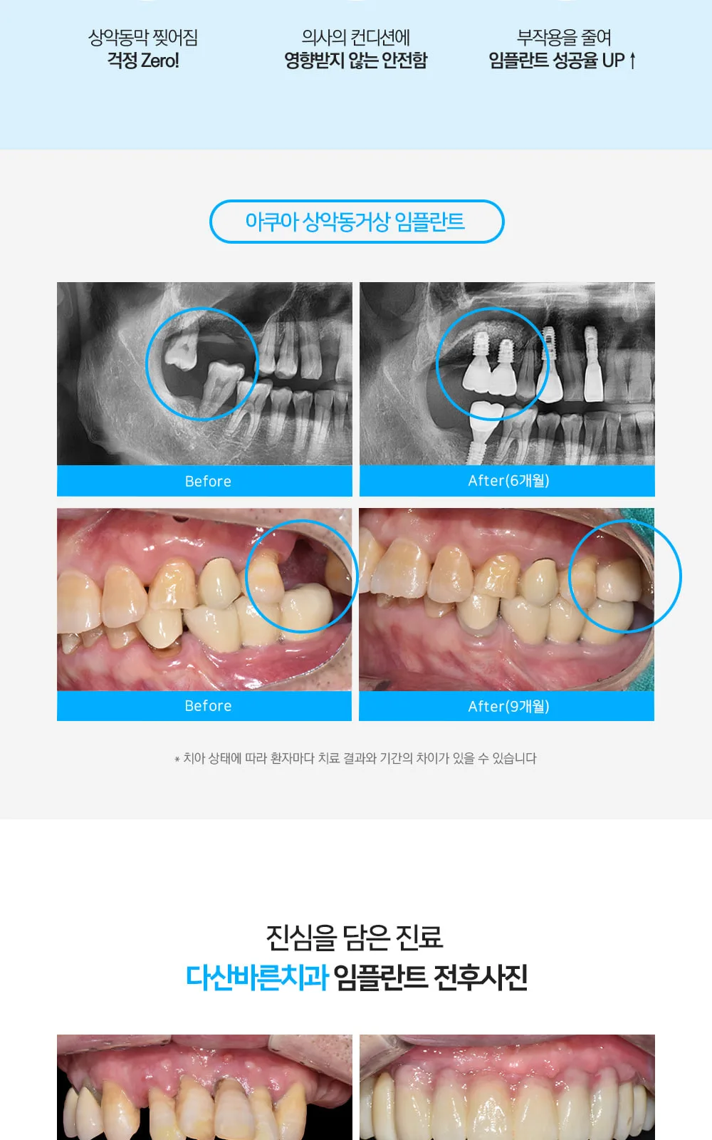 시술 상세 5