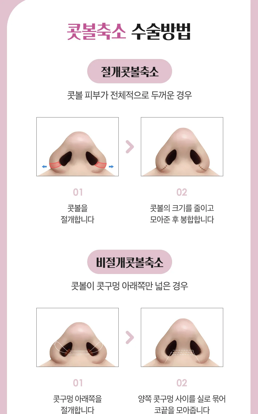시술 상세 5