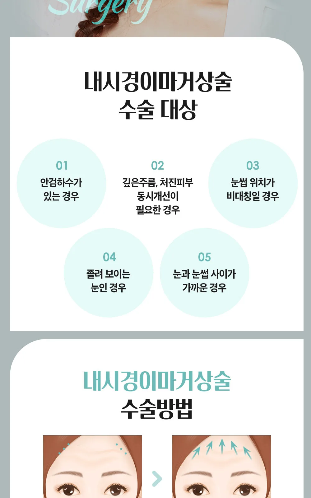 시술 상세 4