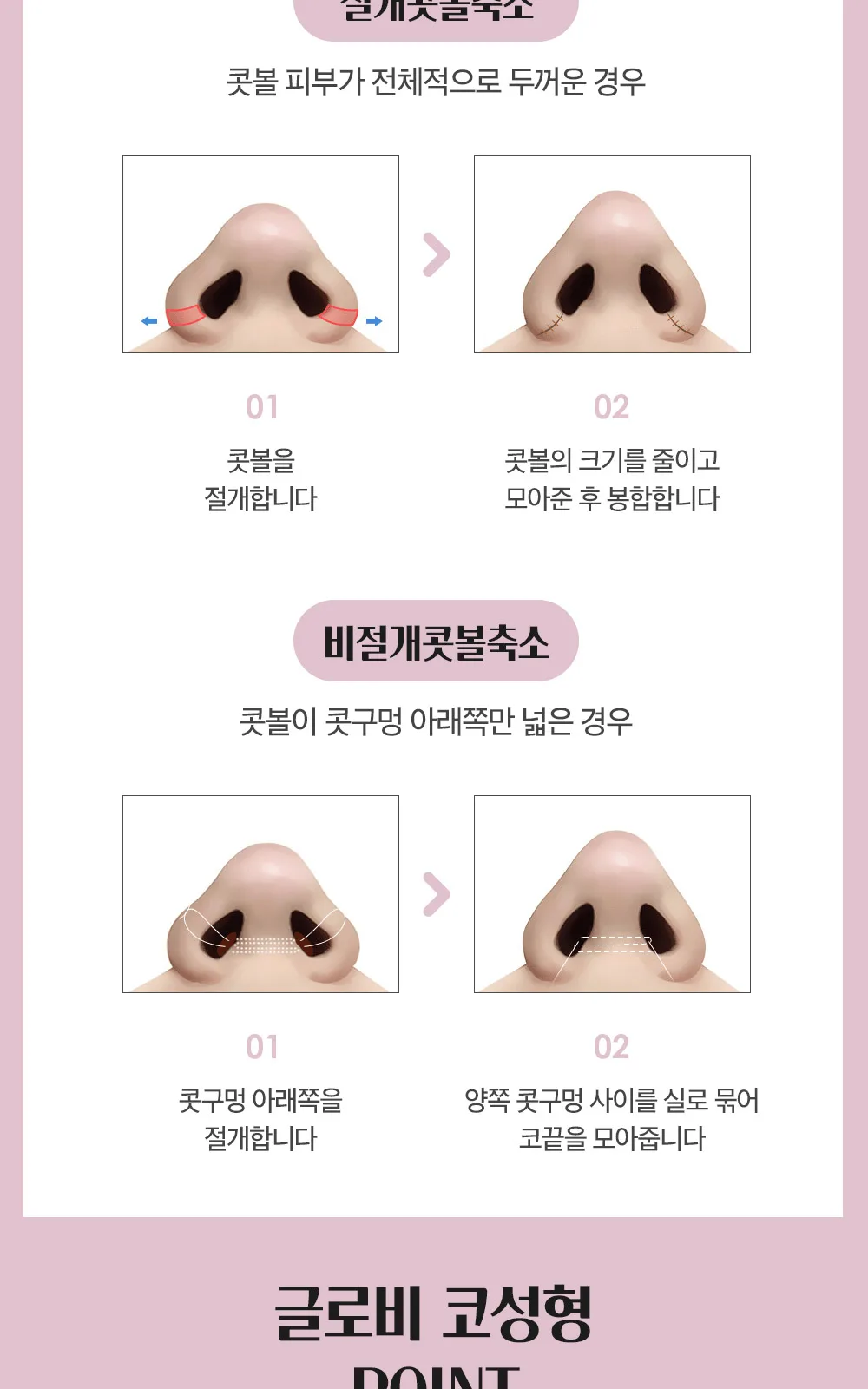 시술 상세 7