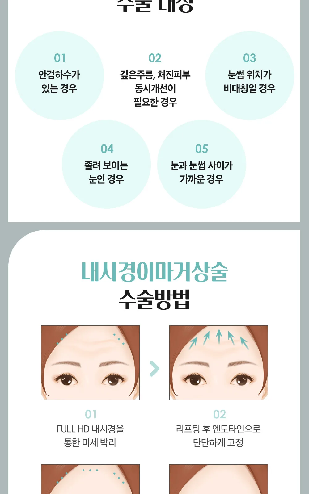 시술 상세 13