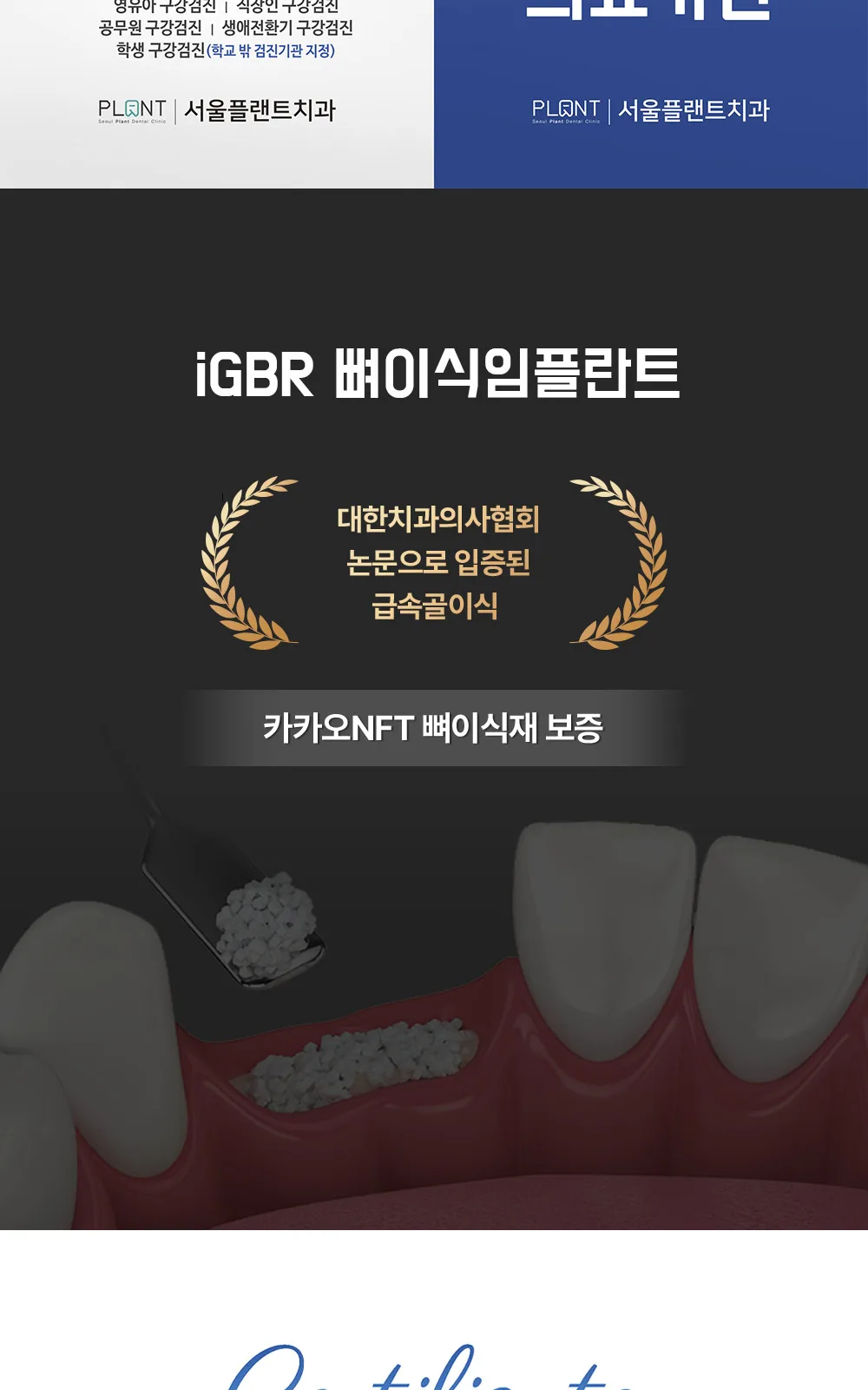 시술 상세 12