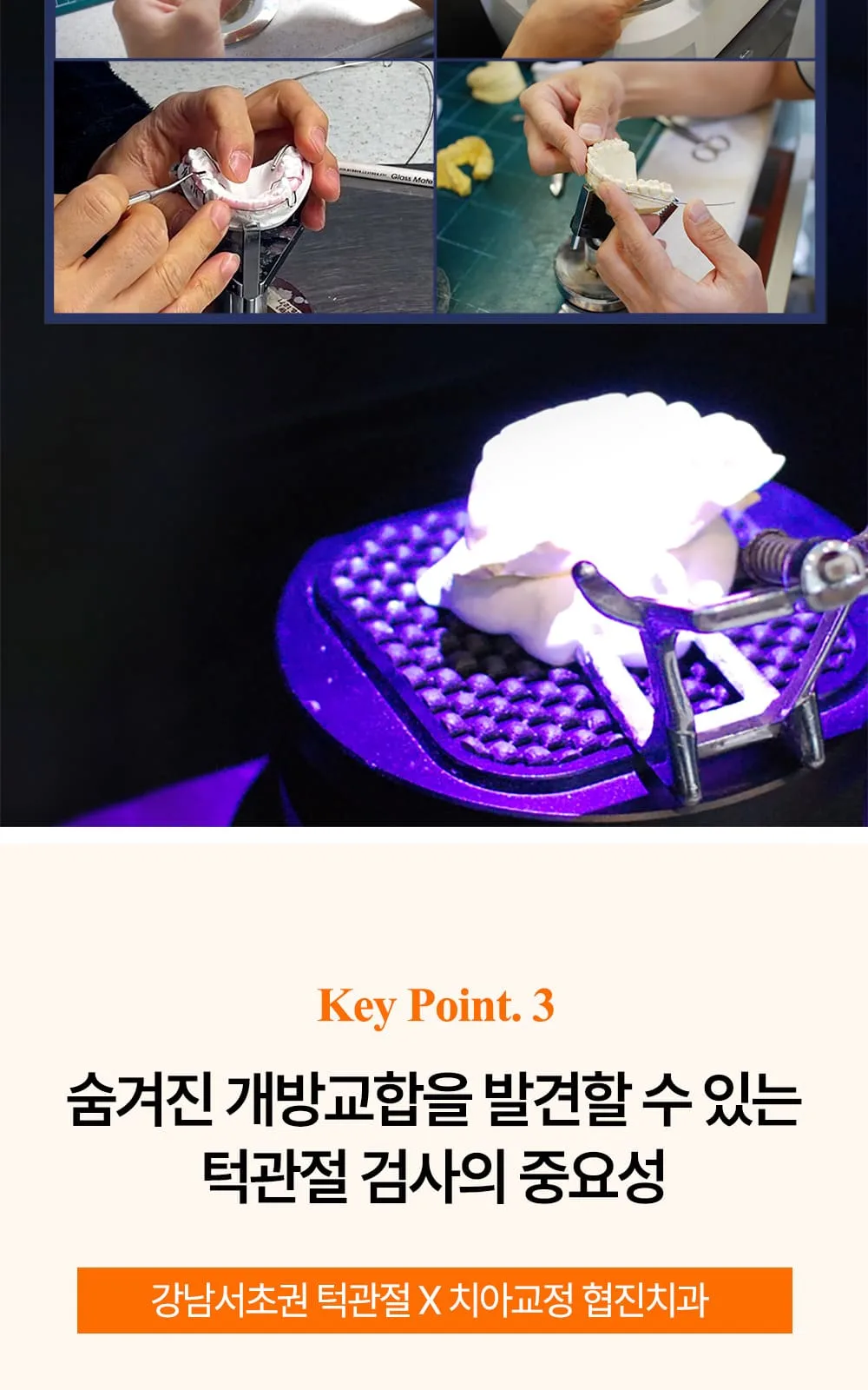 시술 상세 17