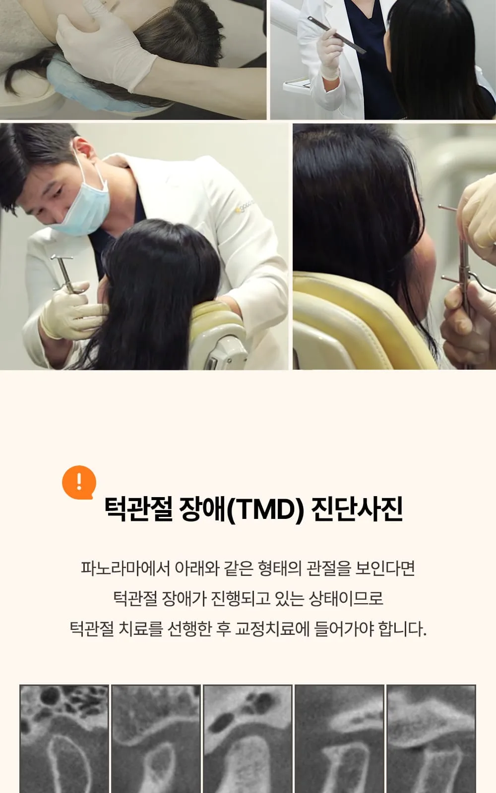 시술 상세 19