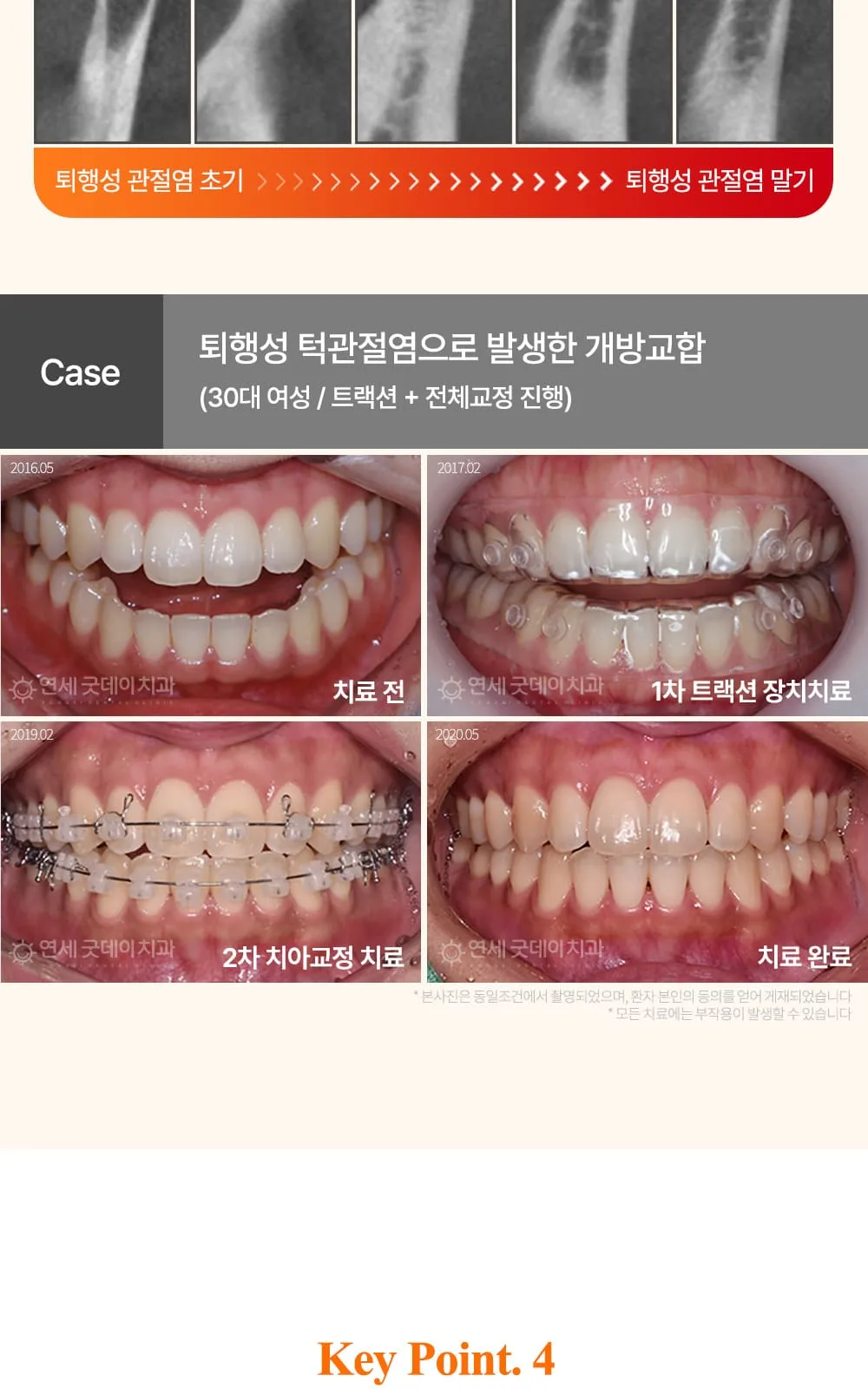 시술 상세 20