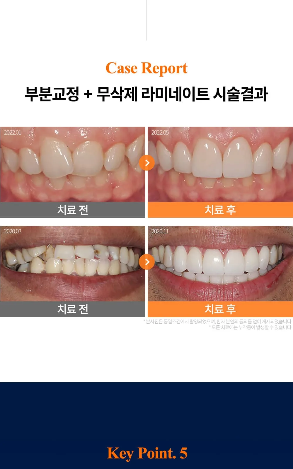 시술 상세 25