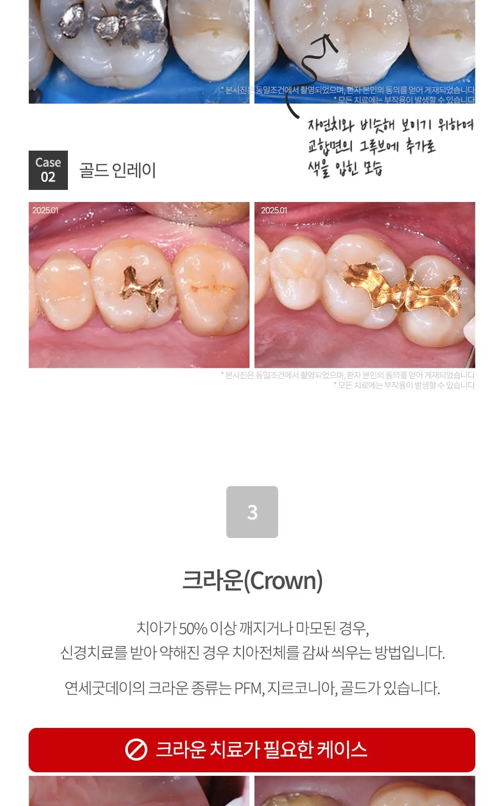 시술 상세 10