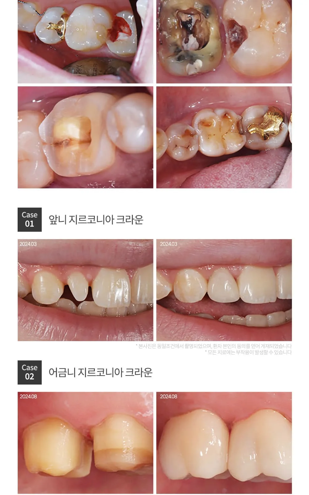 시술 상세 11