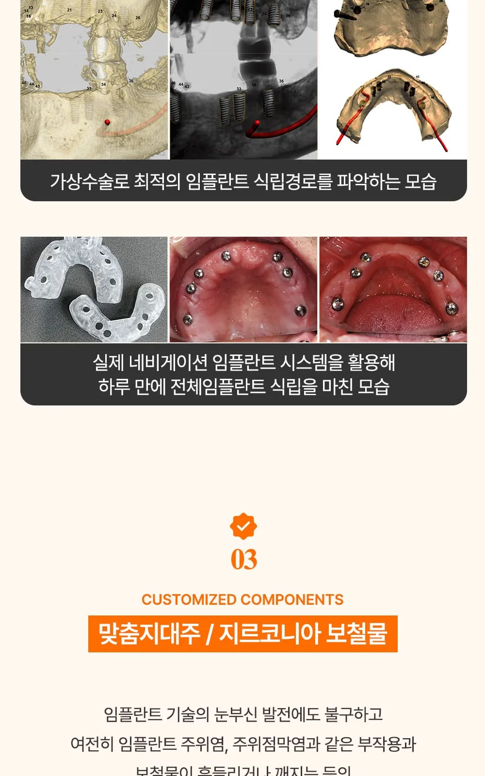 시술 상세 15