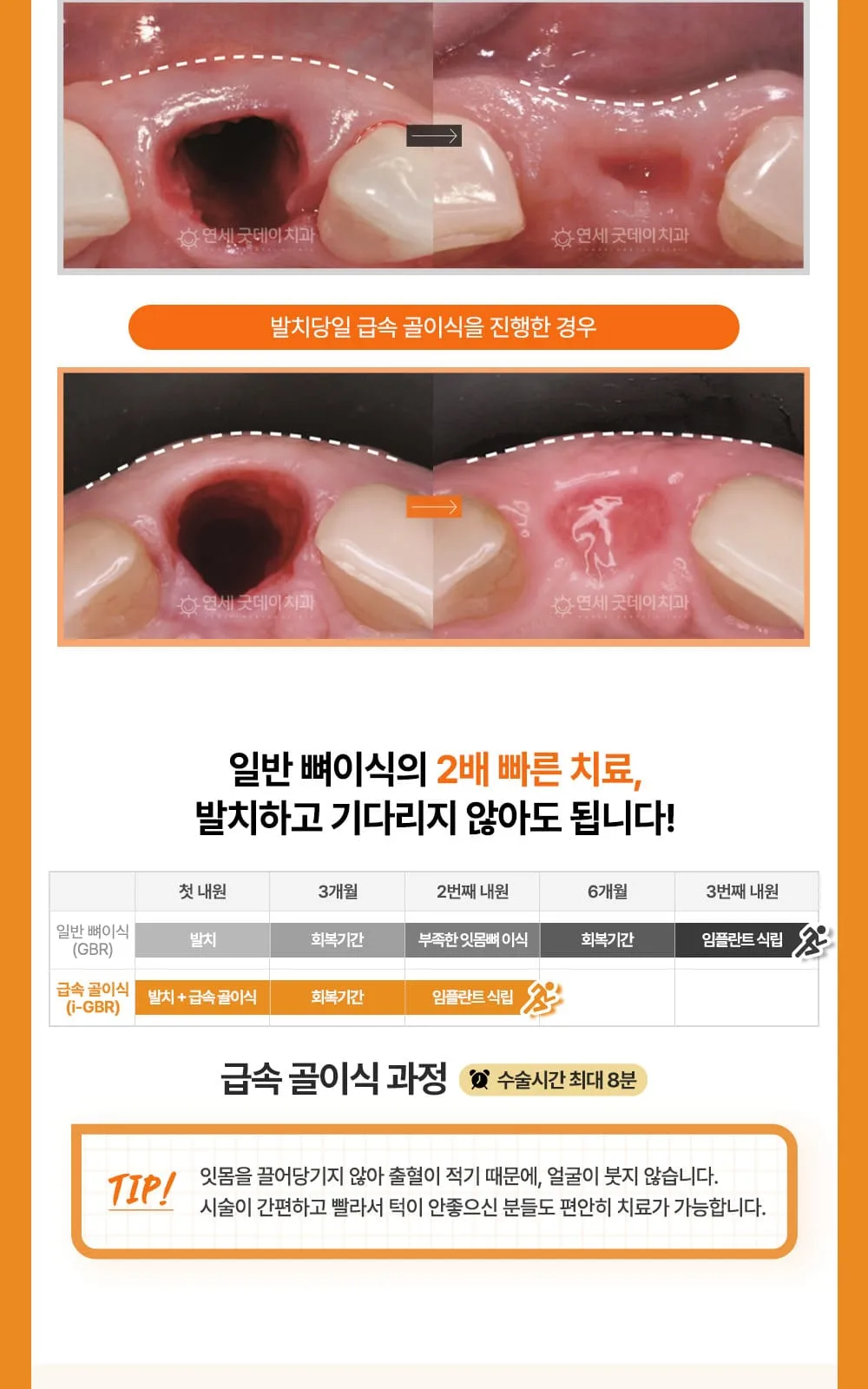 시술 상세 7