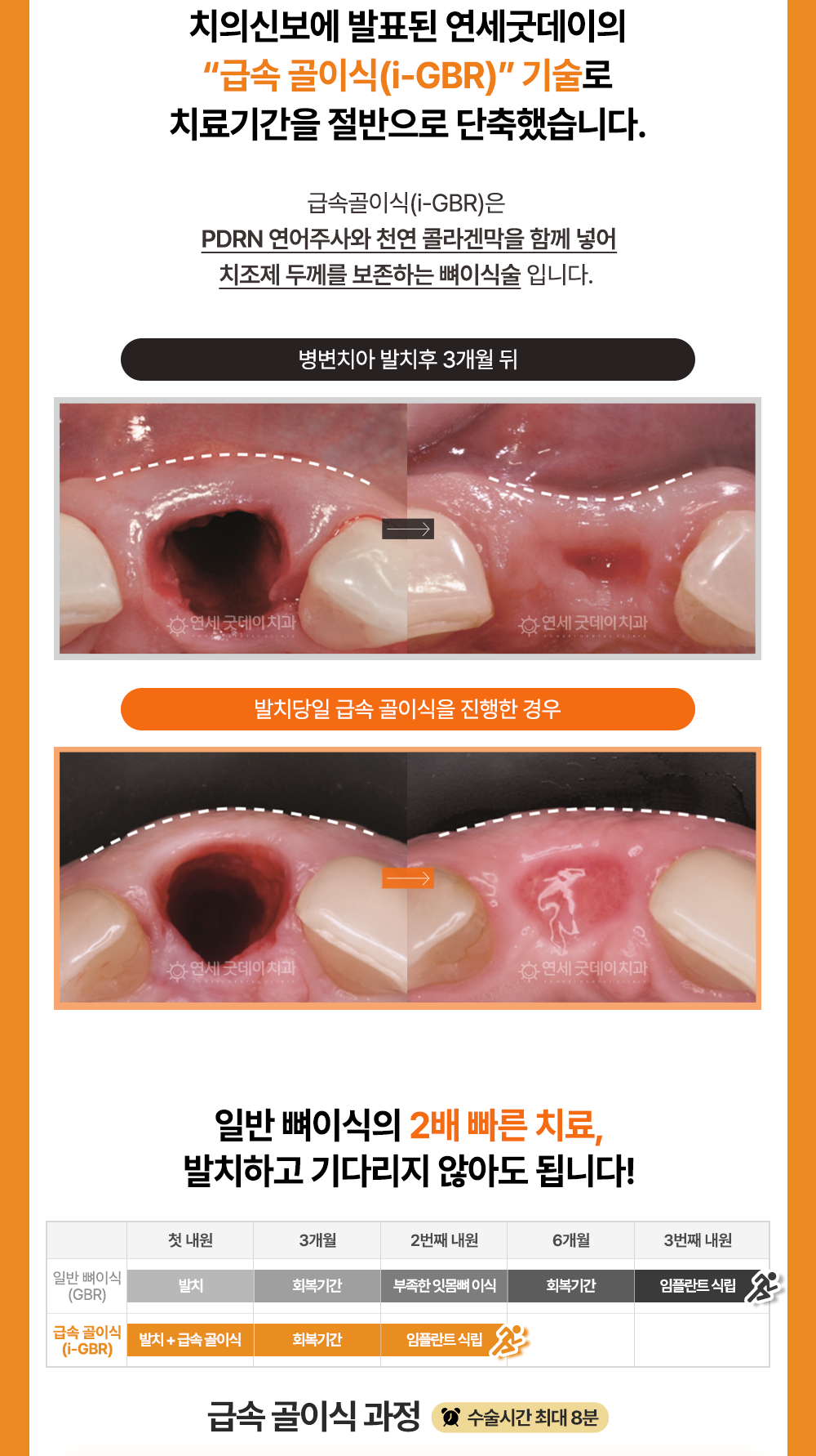 시술 상세 4
