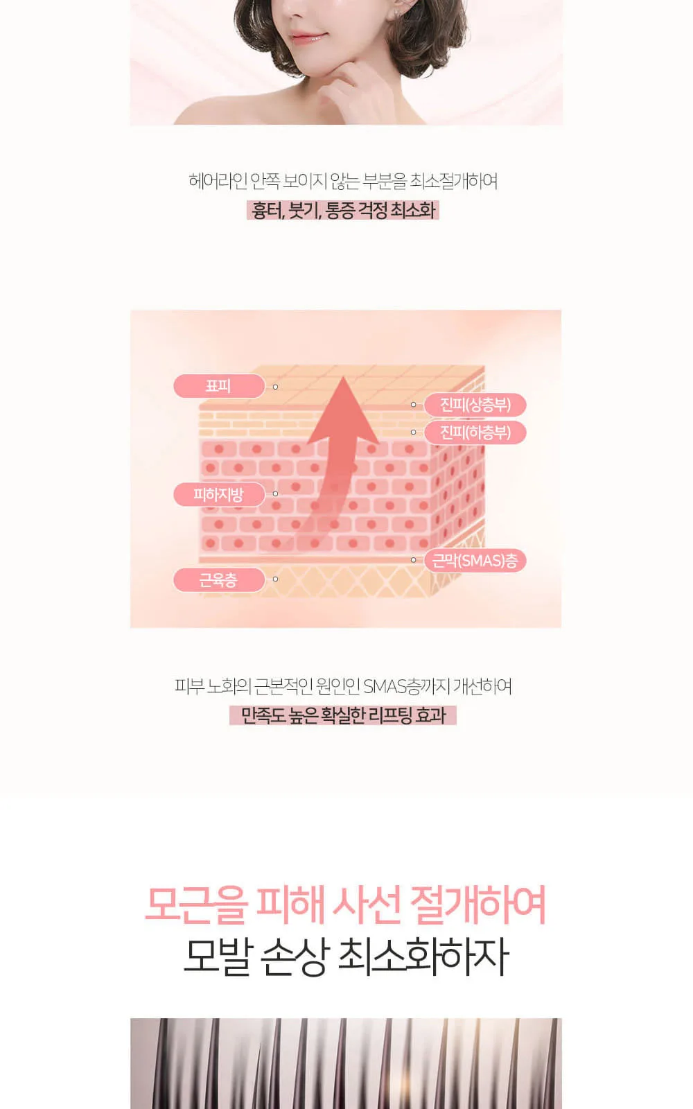 시술 상세 5
