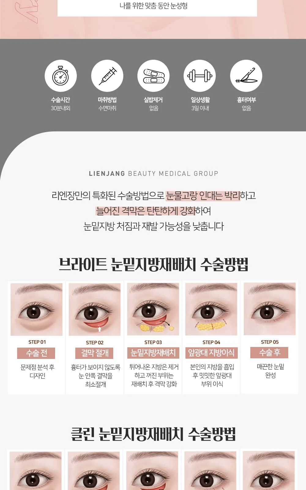 시술 상세 4