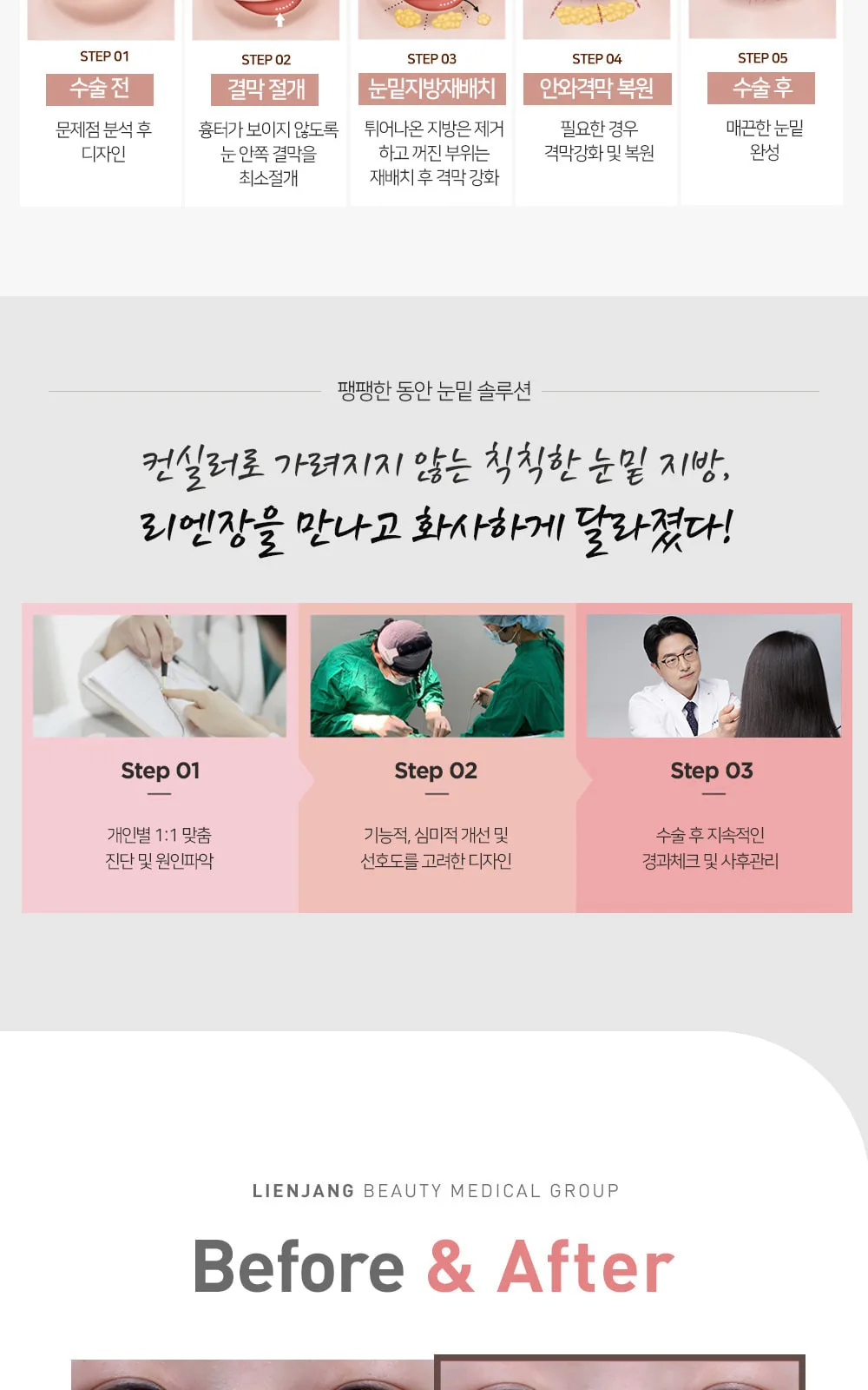 시술 상세 5