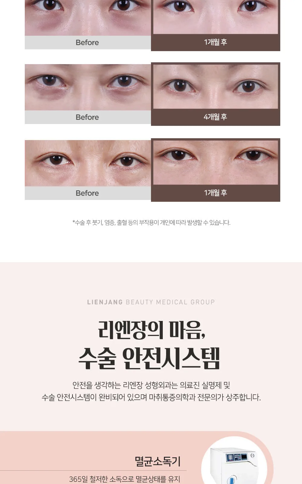 시술 상세 6