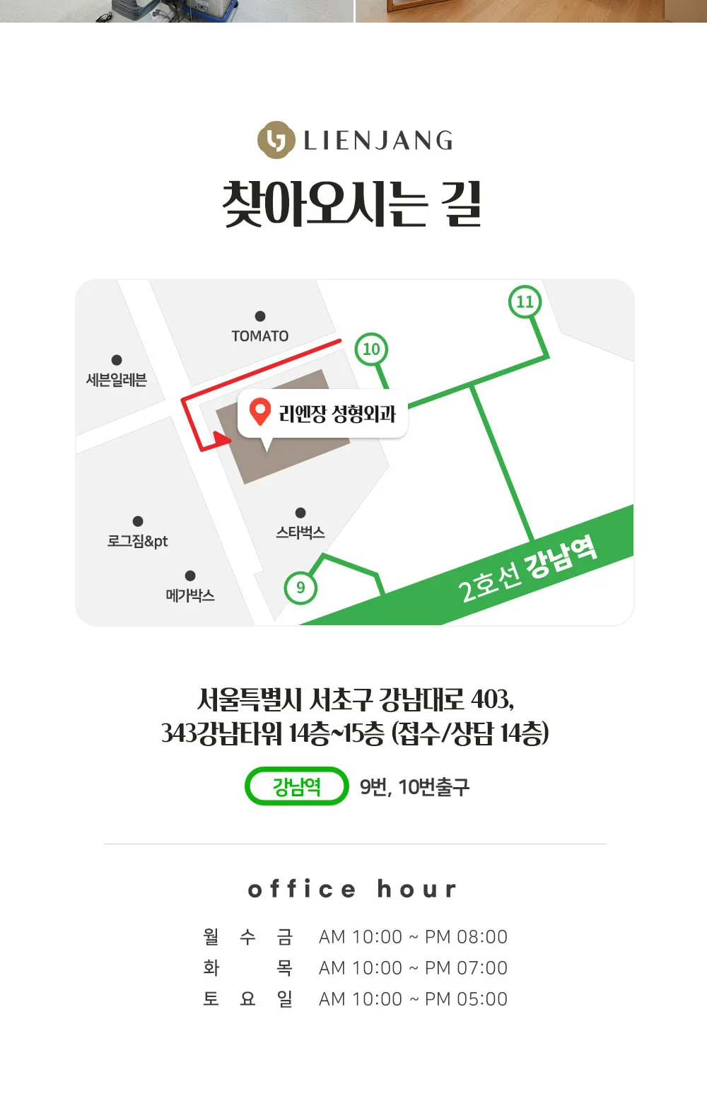 시술 상세 10