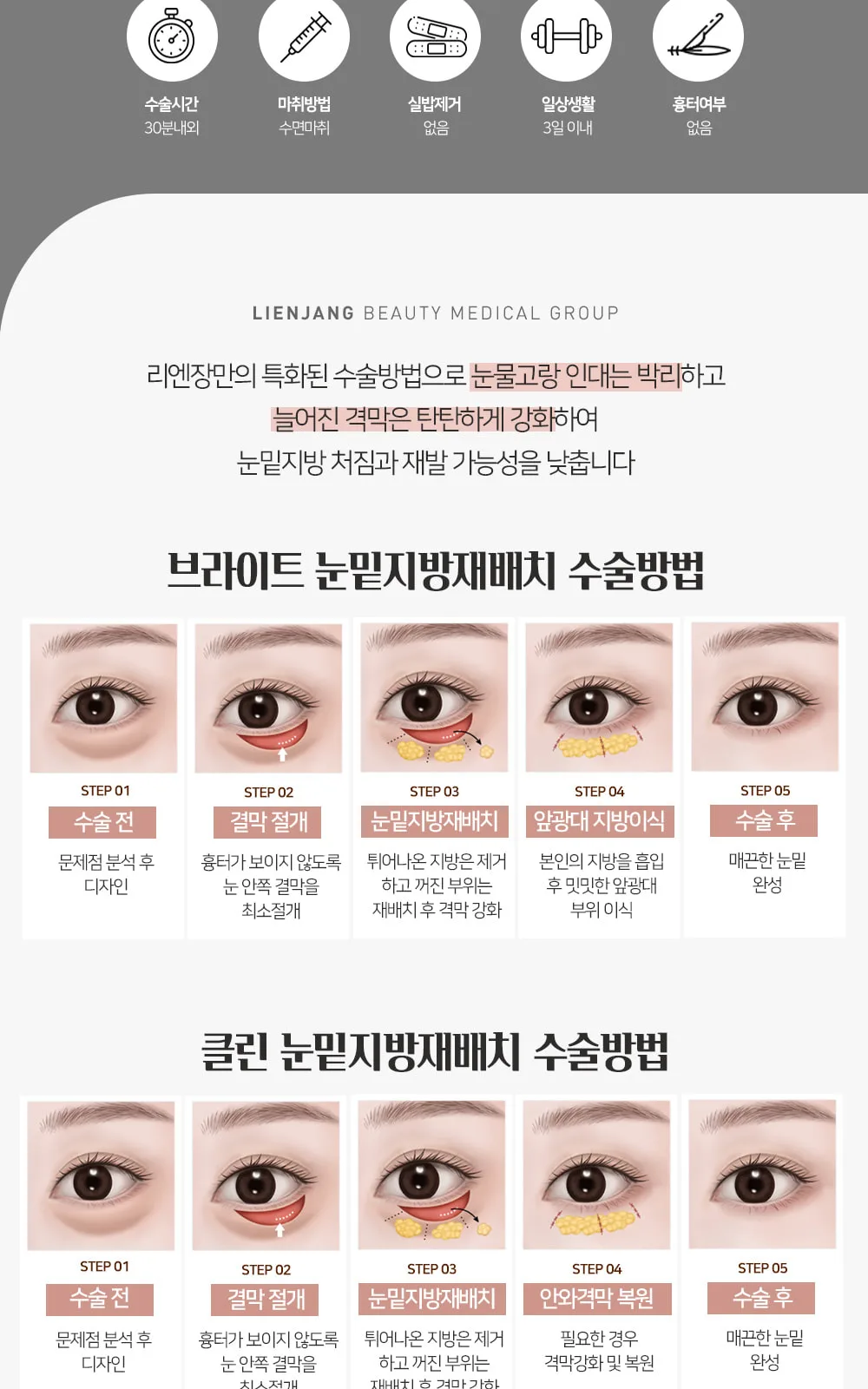 시술 상세 5