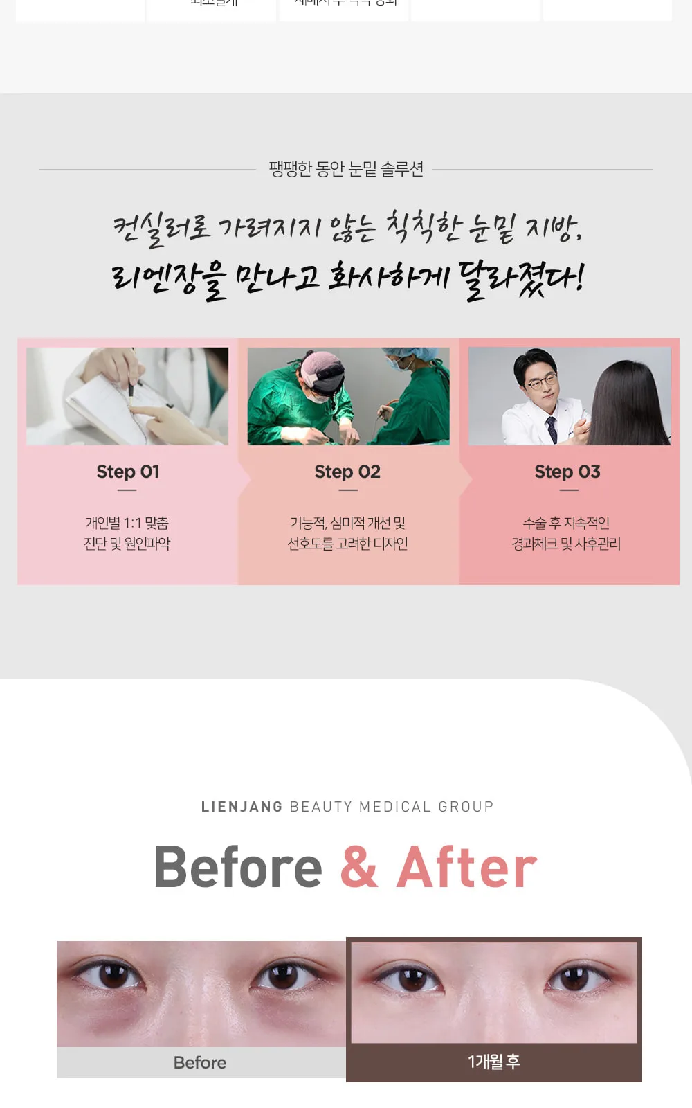 시술 상세 6