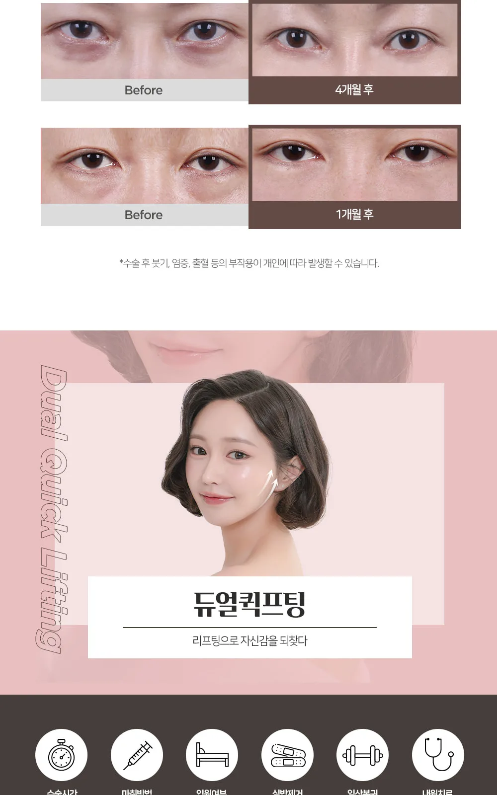 시술 상세 7