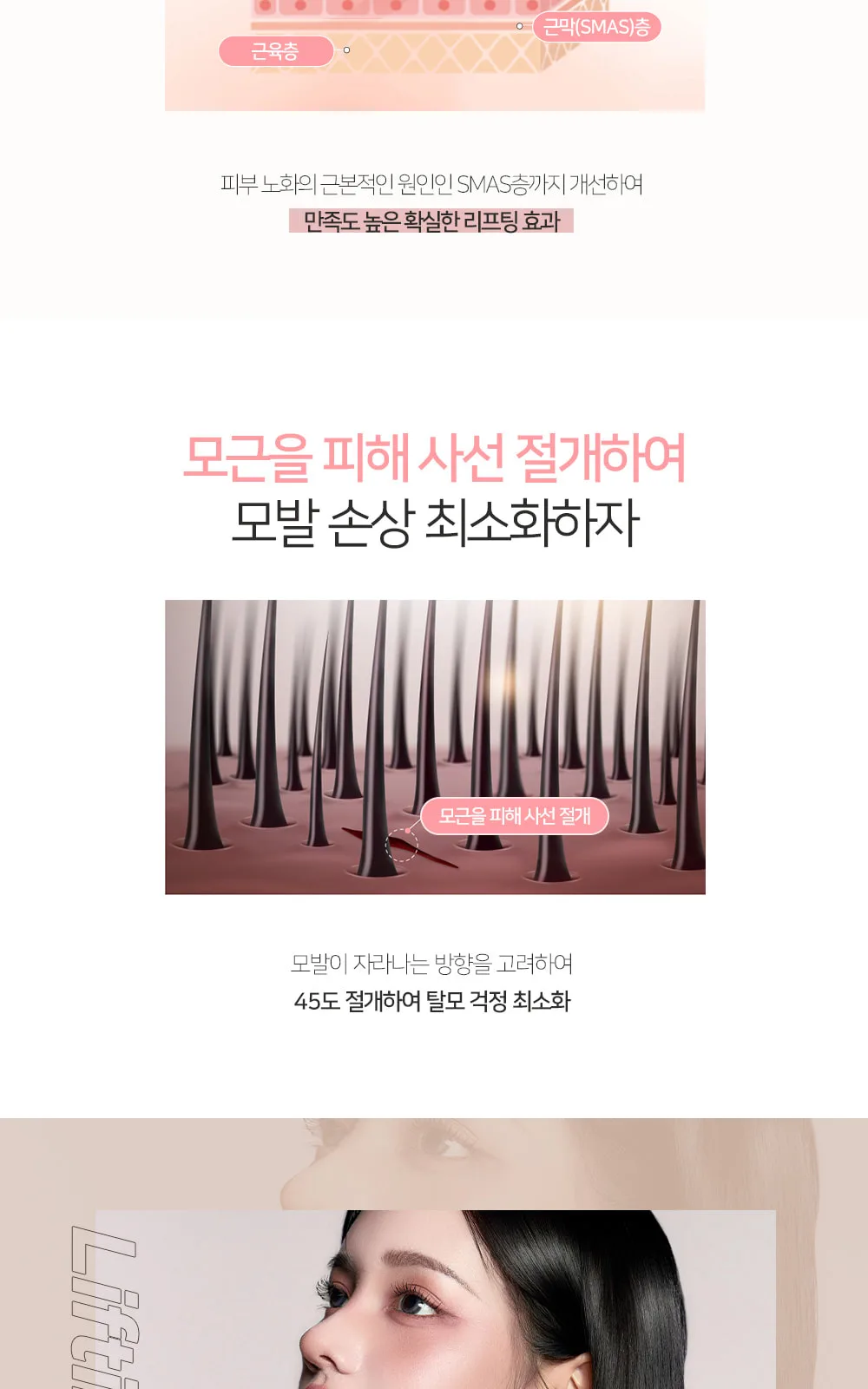 시술 상세 9