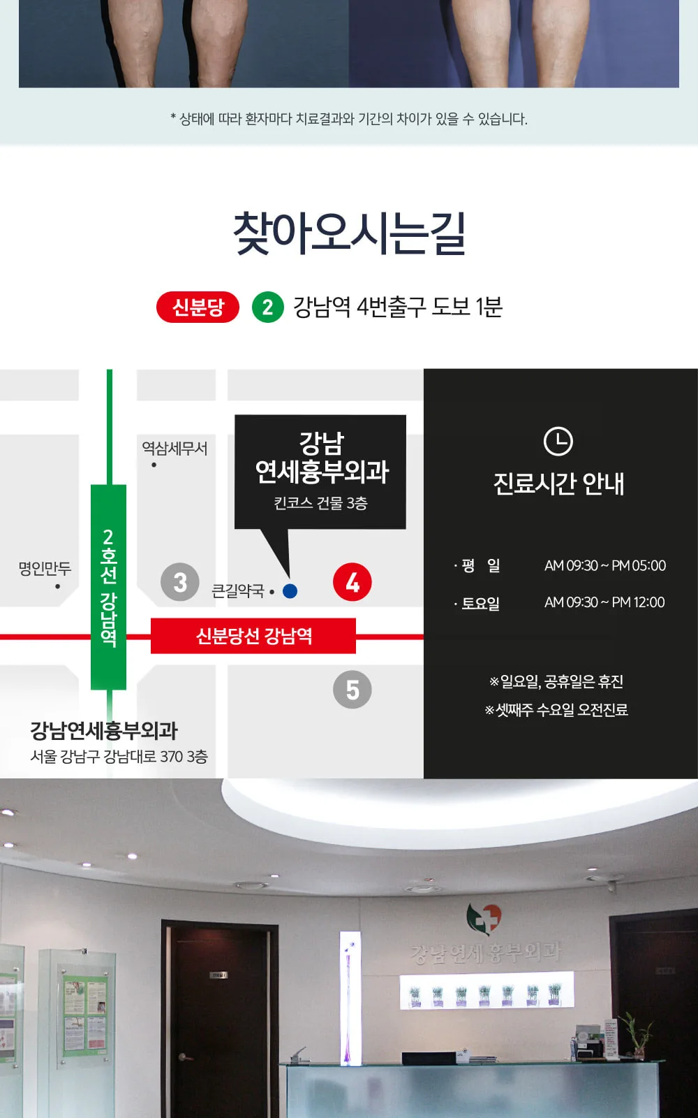 시술 상세 7