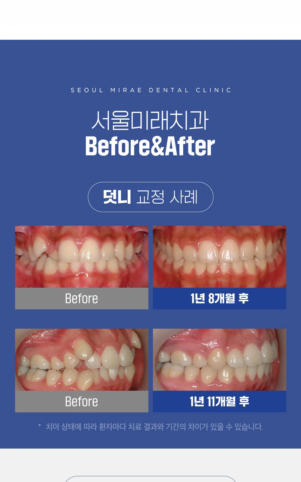 시술 상세 8