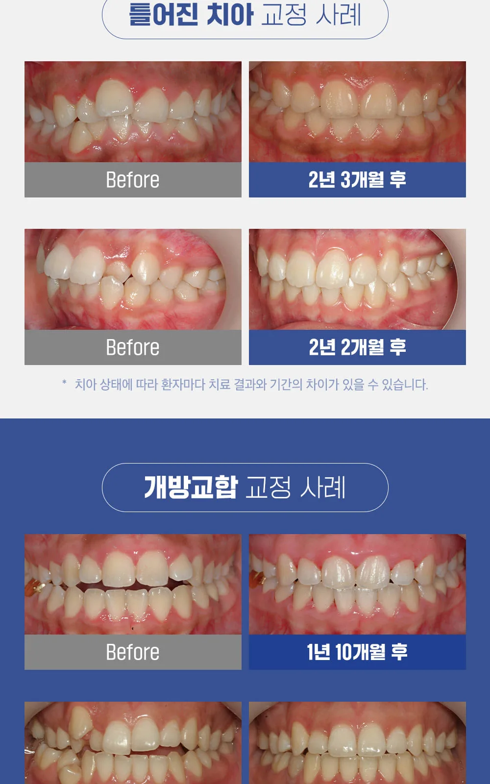 시술 상세 9