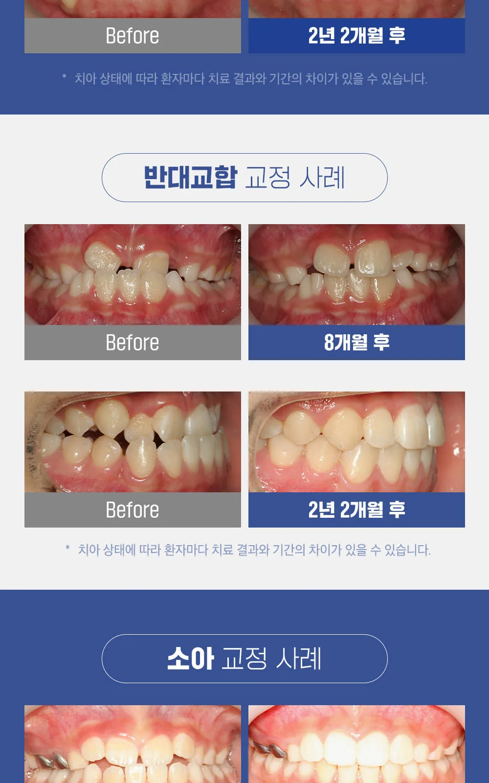 시술 상세 10