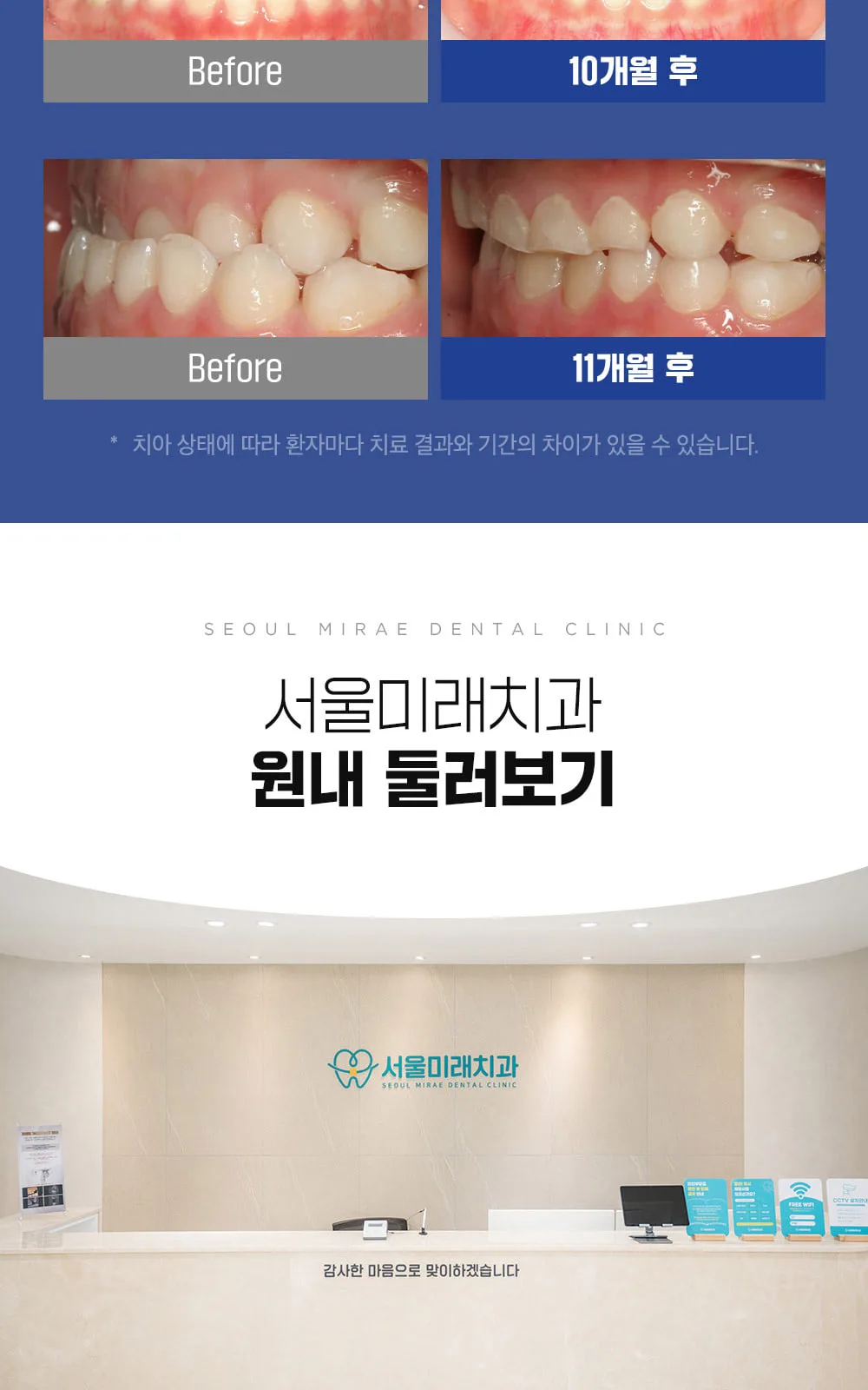 시술 상세 11
