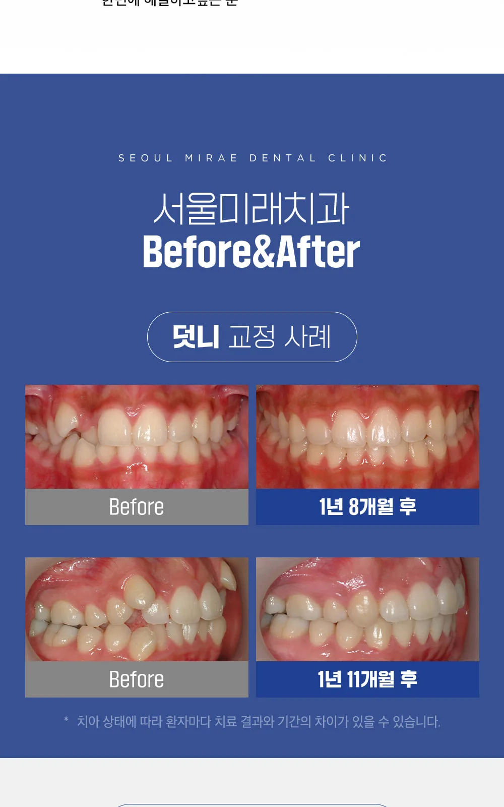 시술 상세 9