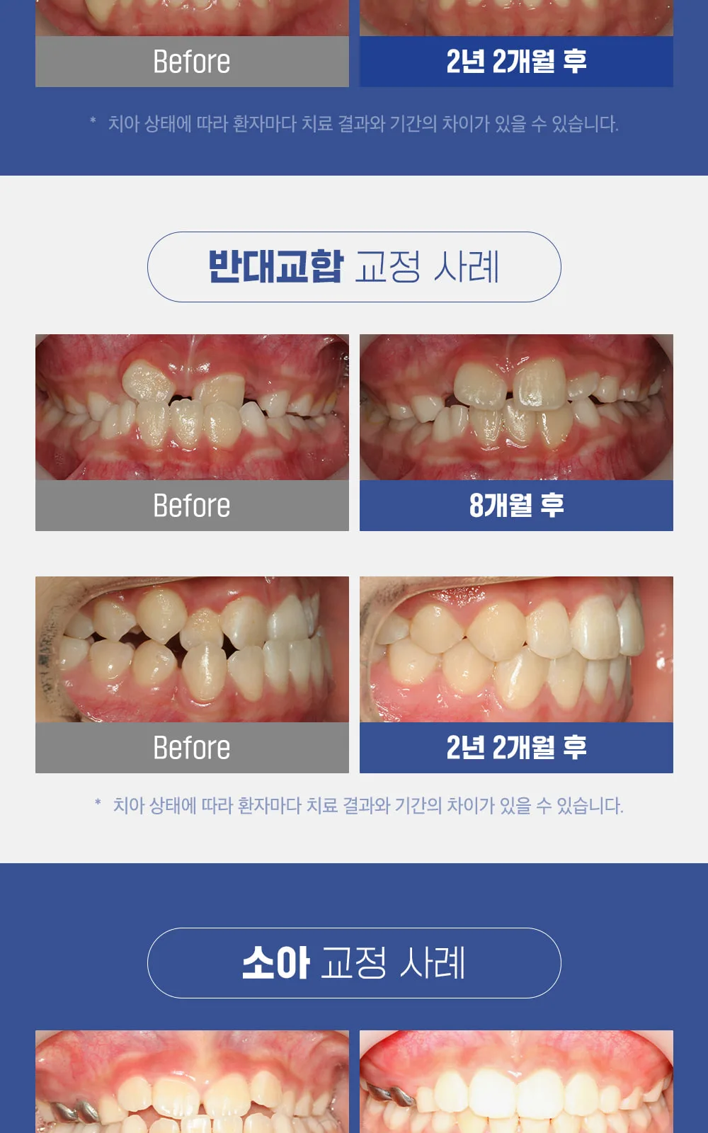 시술 상세 11