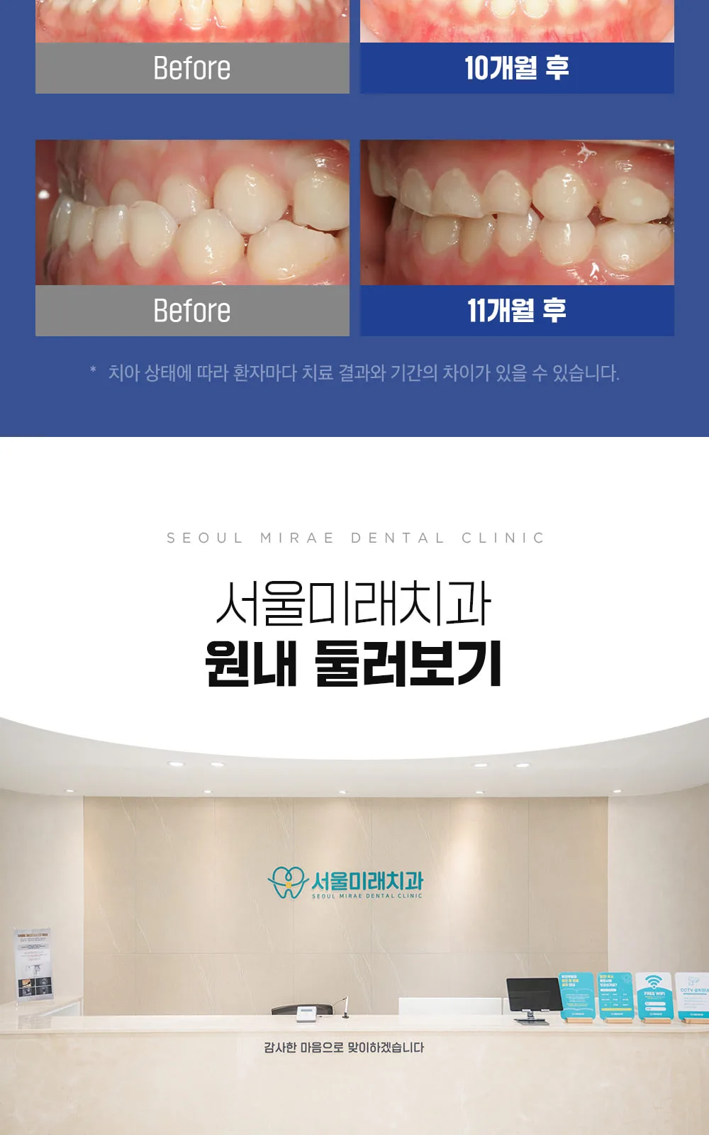 시술 상세 12