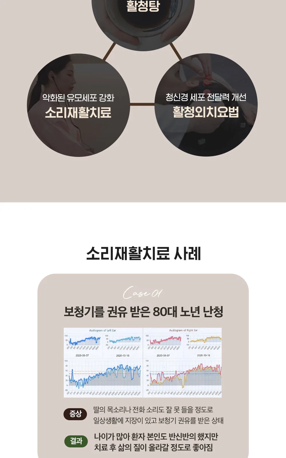 시술 상세 6