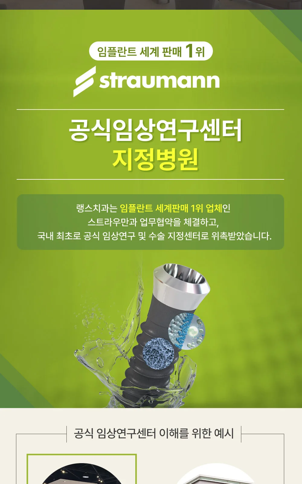 시술 상세 6